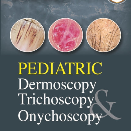 Pediatric Dermoscopy Trichoscopy & Onychoscopy