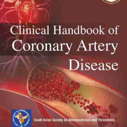 Clinical Handbook of Coronary Artery Disease