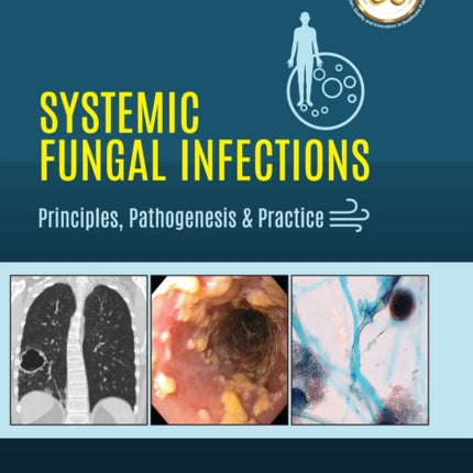 Systemic Fungal Infections: Principles, Pathogenesis & Practice