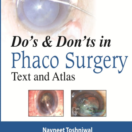 Do's & Dont's in Phaco Surgery: Text and Atlas