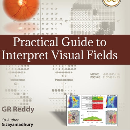 Practical Guide to Interpret Visual Fields