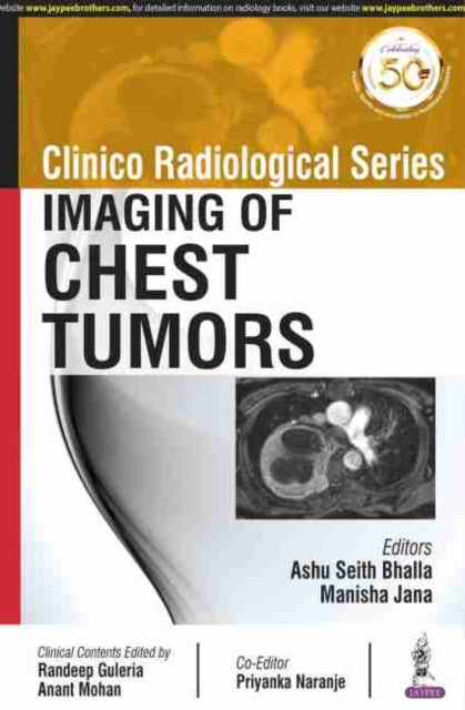 Clinico Radiological Series: Imaging of Chest