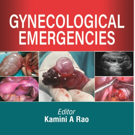 Gynecological Emergencies