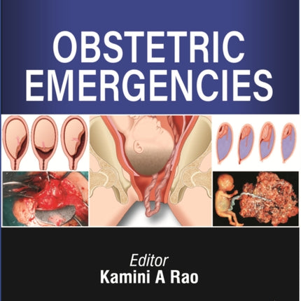 Obstetric Emergencies
