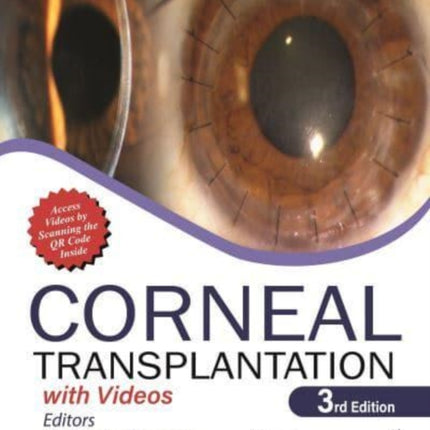 Corneal Transplantation: with Videos