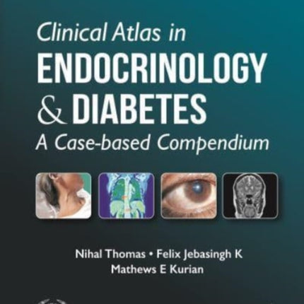 Clinical Atlas in Endocrinology and Diabetes: A