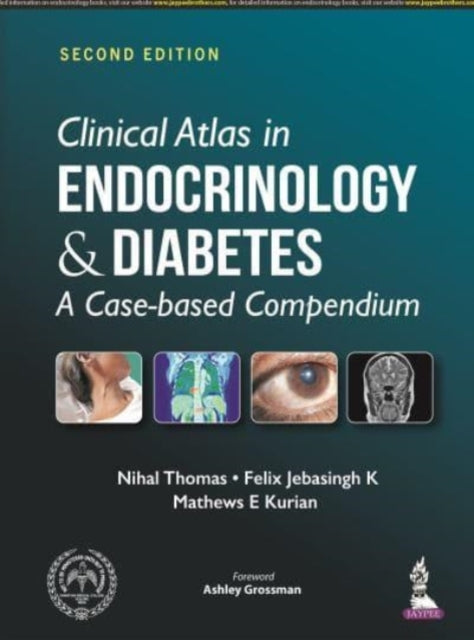 Clinical Atlas in Endocrinology and Diabetes: A