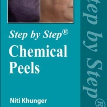 Step by Step Chemical Peels