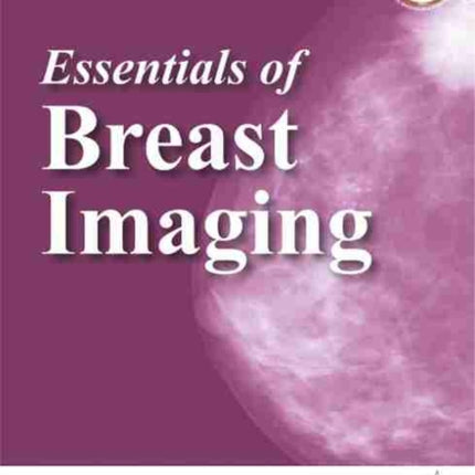 Essentials of Breast Imaging