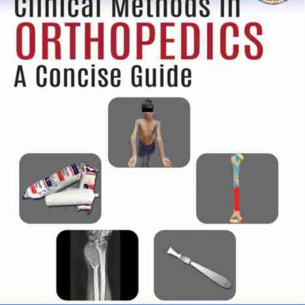 Clinical Methods in Orthopedics: A Concise Guide