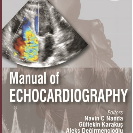 Manual of Echocardiography