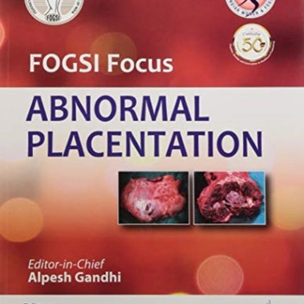 FOGSI Focus Abnormal Placentation