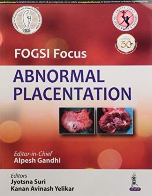 FOGSI Focus Abnormal Placentation