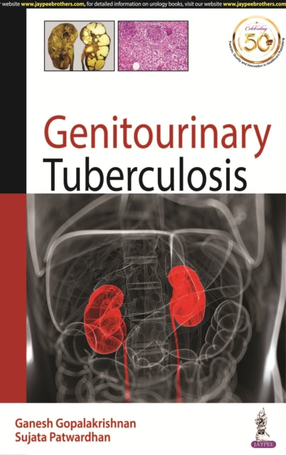 Genitourinary Tuberculosis