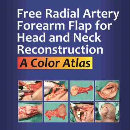 Free Radial Artery Forearm Flap for Head and Neck