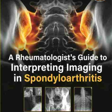 A Rheumatologist's Guide to Interpreting Imaging