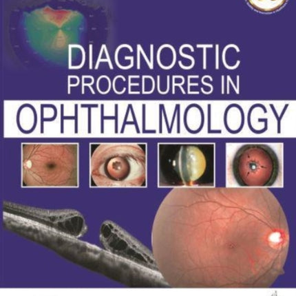Diagnostic Procedures in Ophthalmology