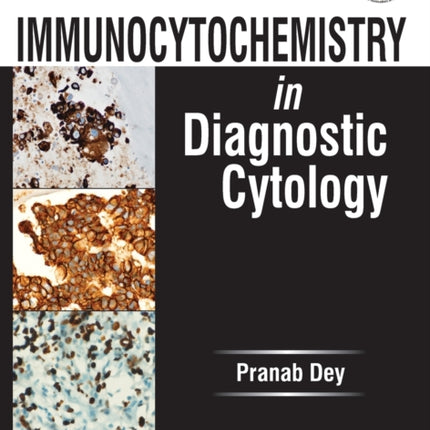 Immunocytochemistry in Diagnostic Cytology