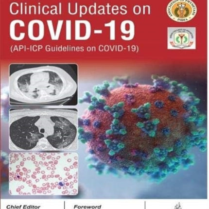 Clinical Updates on COVID-19