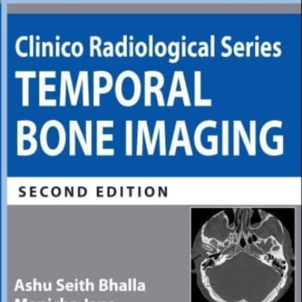 Clinico Radiological Series: Temporal Bone