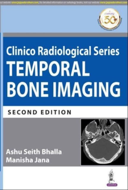 Clinico Radiological Series: Temporal Bone