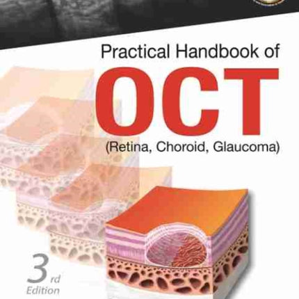Practical Handbook of OCT: (Retina, Choroid,