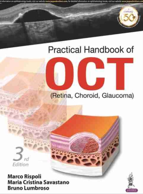 Practical Handbook of OCT: (Retina, Choroid,