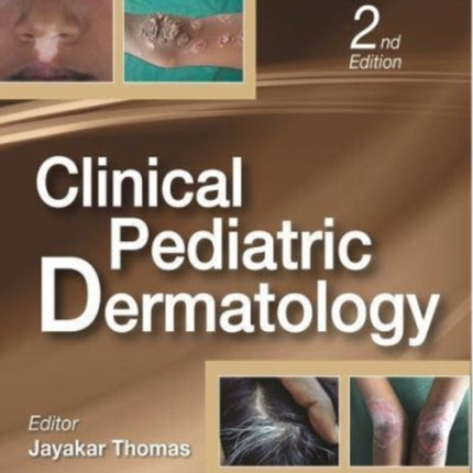 Clinical Pediatric Dermatology