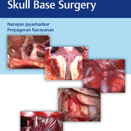 Atlas of 360 Degree Skull Base Surgery