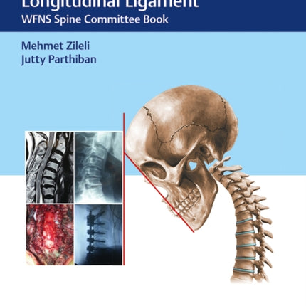 Cervical Spondylotic Myelopathy and Ossification of Posterior Longitudinal Ligament: WFNS Spine Committee Book