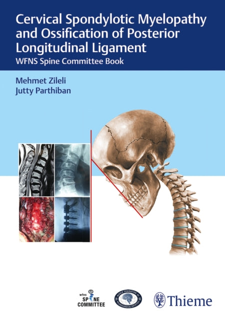 Cervical Spondylotic Myelopathy and Ossification of Posterior Longitudinal Ligament: WFNS Spine Committee Book