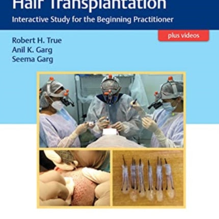 Practical Guide to Hair Transplantation: Interactive Study for the Beginning Practitioner