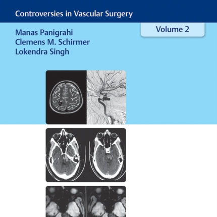 Neurosurgery Updates, Vol. 2: Controversies in Vascular Surgery