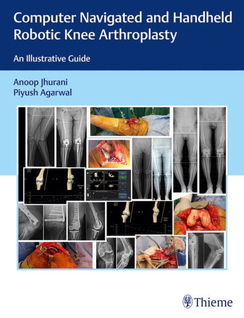 Computer Navigated and Handheld Robotic Knee Arthroplasty: An Illustrative Guide