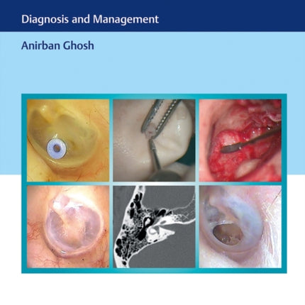 Color Atlas of Otology: Diagnosis and Management