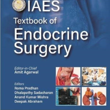 Textbook of Endocrine Surgery