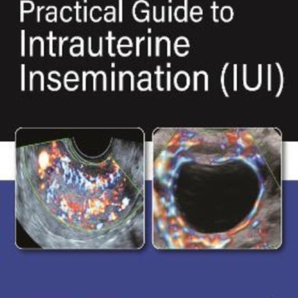 Practical Guide to Intrauterine Insemination
