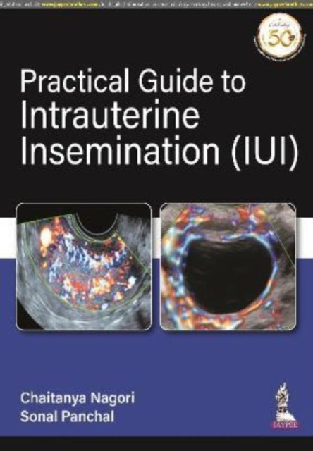 Practical Guide to Intrauterine Insemination