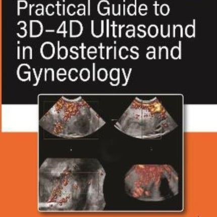 Practical Guide to 3D-4D Ultrasound in Obstetrics