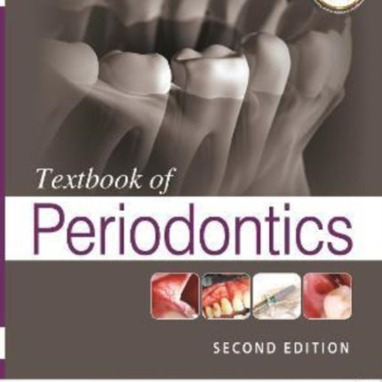 Textbook of Periodontics