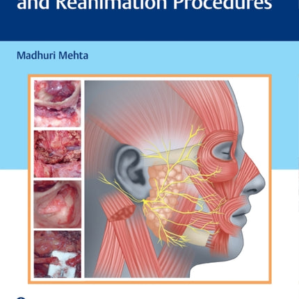 Atlas of Facial Nerve Surgeries and Reanimation Procedures