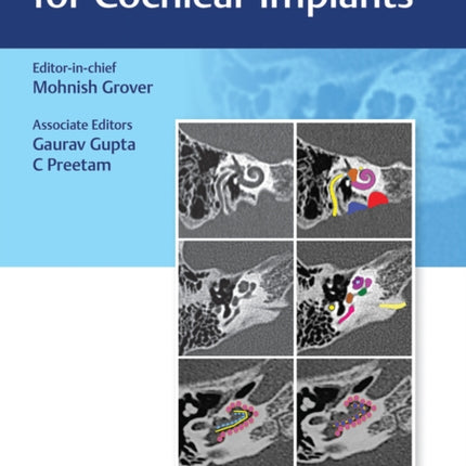 Textbook of Radiology for Cochlear Implants