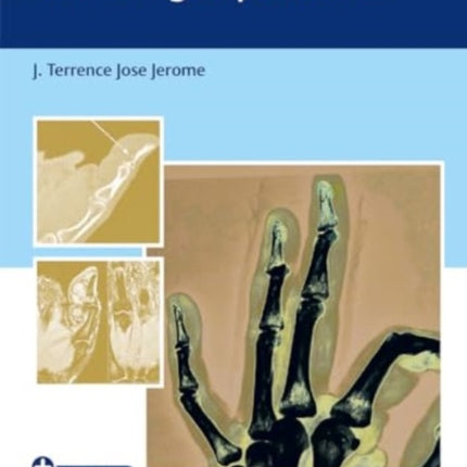 An Evidence-Based Approach to the Fingertip