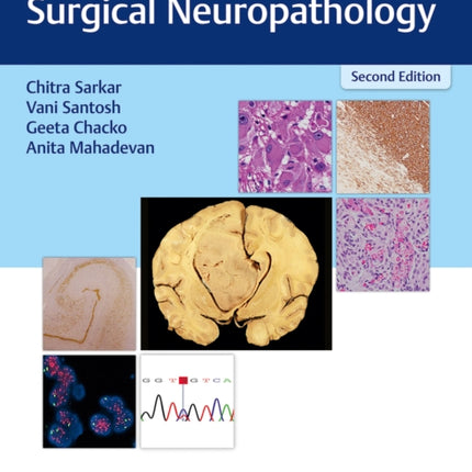 Essentials of Diagnostic Surgical Neuropathology