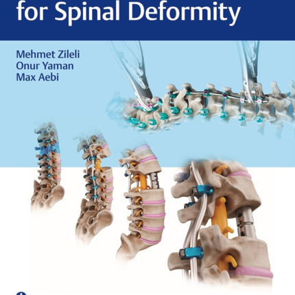 Correction Techniques for Spinal Deformity