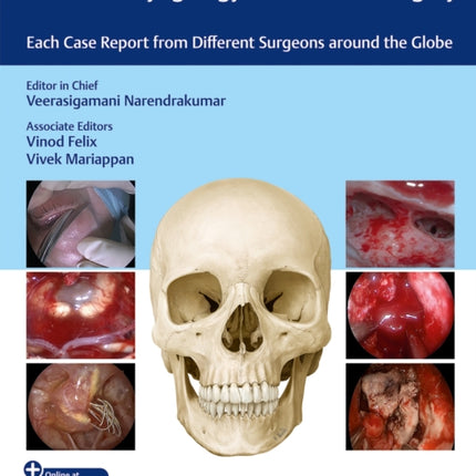 100 Complications of Otorhinolaryngology  Skull