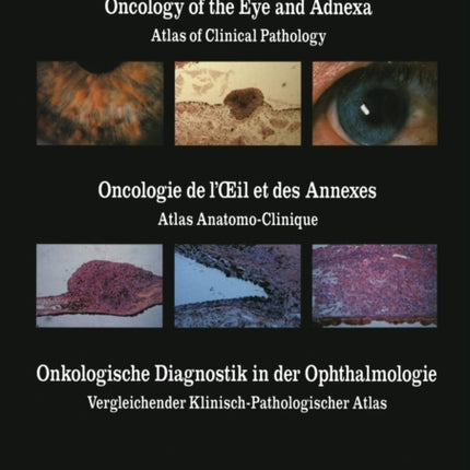Oncology of the Eye and Adnexa / Oncologie de l’Œil et des Annexes / Onkologische Diagnostik in der Ophthalmologie: Atlas of Clinical Pathology / Atlas Anatomo-Clinique / Vergleichender Klinisch-Pathologischer Atlas