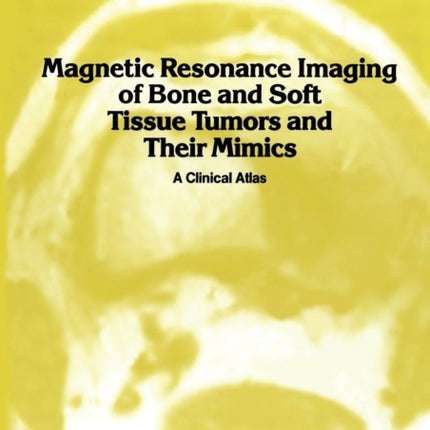 Magnetic Resonance Imaging of Bone and Soft Tissue Tumors and Their Mimics: A Clinical Atlas
