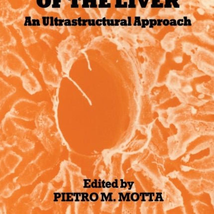 Biopathology of the Liver: An Ultrastructural Approach