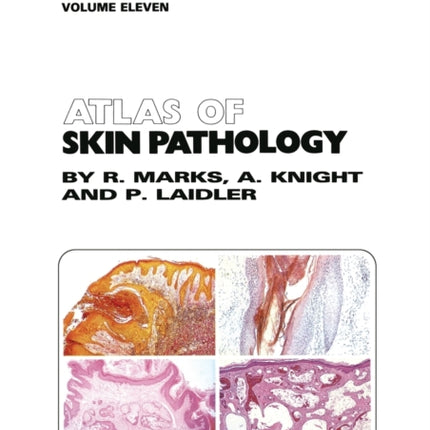 Atlas of Skin Pathology
